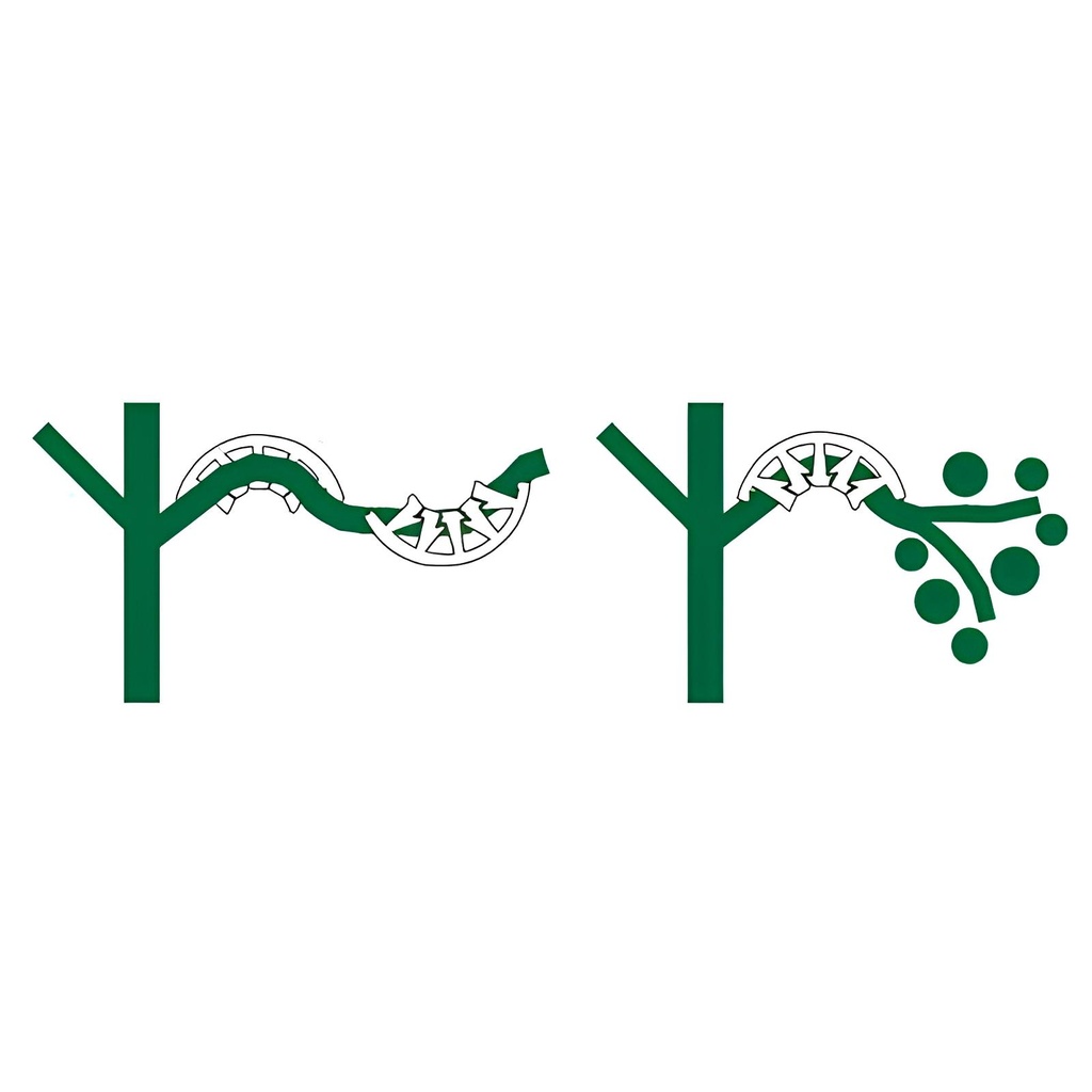 Plant Bends, 50 St je Pckg Bild 2